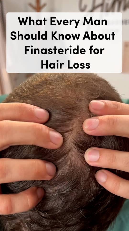The truth about finasteride for hair loss