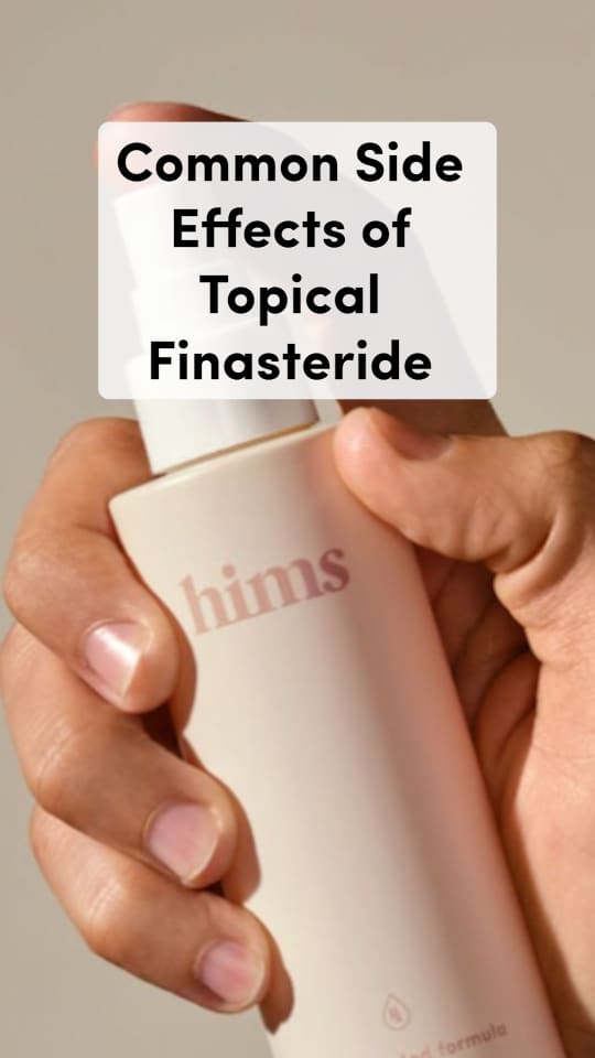 Topical Finasteride Side Effects Explained